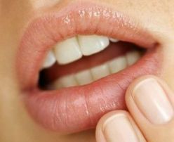 Oral Herpes (Cold Sore) Causes, Treatments, Remedies