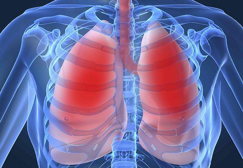 Knowing the Difference Between Bronchitis and Pneumonia