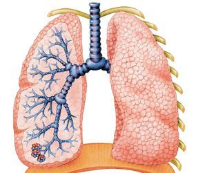 Vitamins, Supplements to Help COPD